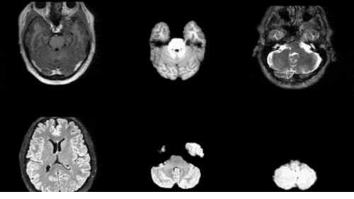 A visual representation of 3D medical brain MRI scans generated synthetically by NVIDIA's MAISI model.